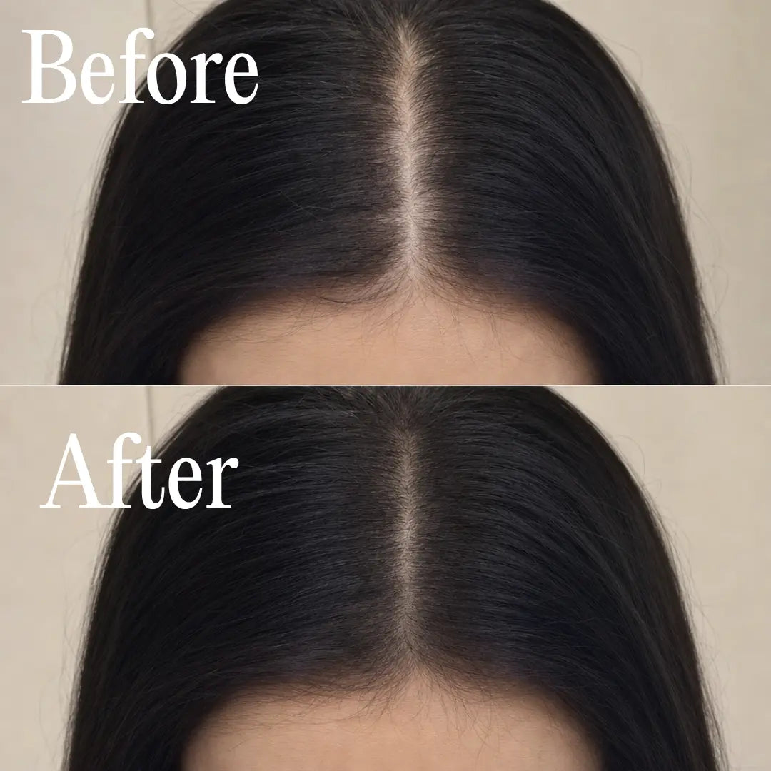Korean Scalp Reset Bar